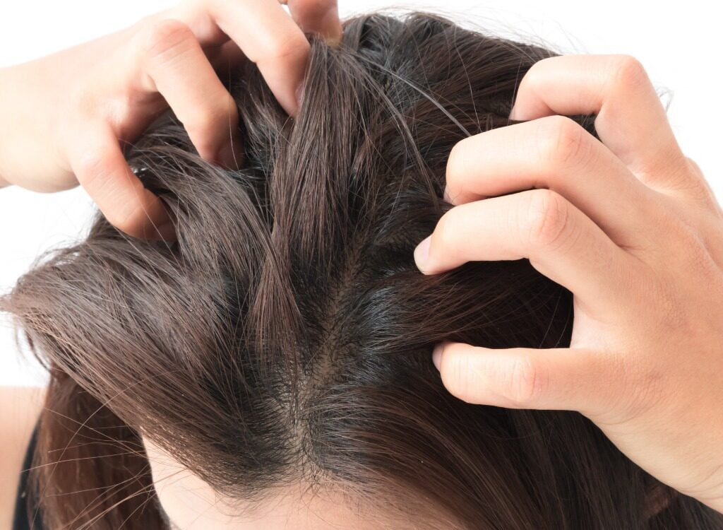 swędzenie skóry głowy domowe sposoby