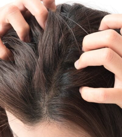 swędzenie skóry głowy domowe sposoby